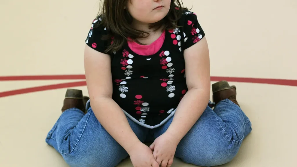 Childhood Obesity in 2024-2025: Global Trends and Persistent Challenges Childhood Obesity in 2024-2025: Global Trends and Persistent Challenges